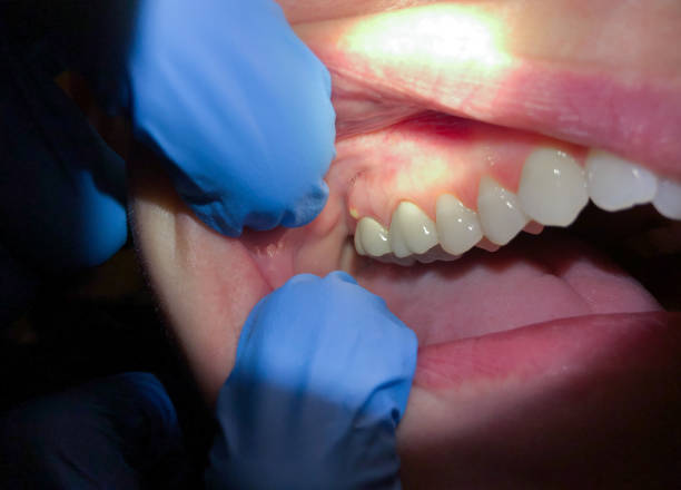 Best Walk-In Emergency Dental Services in Bryan, TX